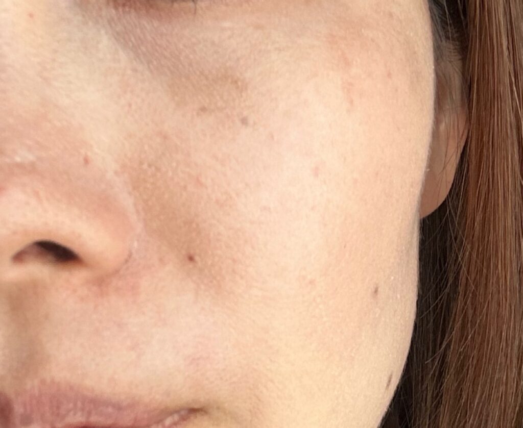 40代女性の肌のくすみ